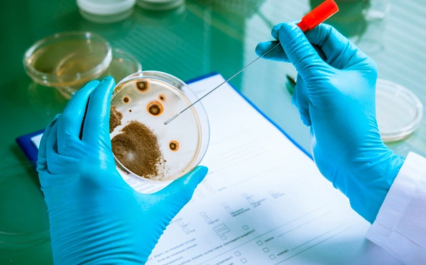 Yeast Two-Hybrid Screening