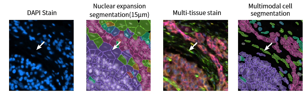 Figure_7._Improved_Accuracy_in_Irregular_Cell_Morphologies.webp Figure_7._Improved_Accuracy_in_Irregular_Cell_Morphologies.webp