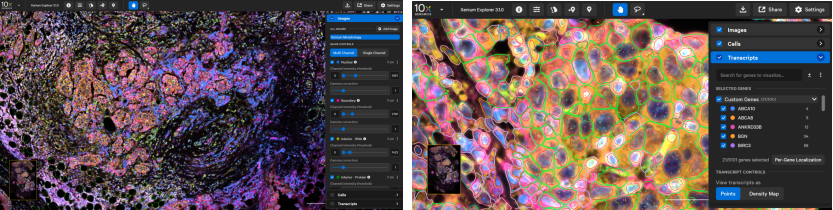 Figure_9._Xenium_Explorer_Output_on_FFPE_Breast_Cancer_Sample.webp Figure_9._Xenium_Explorer_Output_on_FFPE_Breast_Cancer_Sample.webp