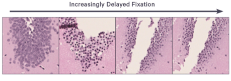 Sample_Preparation_Guide_for_Visium_HD_Spatial_Transcriptomics_4.webp Sample_Preparation_Guide_for_Visium_HD_Spatial_Transcriptomics_4.webp