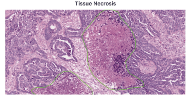 Tissue_Collection_for_Visium_HD_Spatial_Transcriptomics_2.webp Tissue_Collection_for_Visium_HD_Spatial_Transcriptomics_2.webp